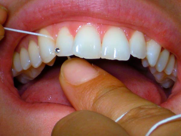Bild Einsatz von Zahnseide